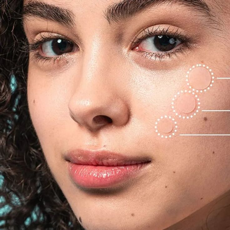 COSRX - Acne Pimple Master Patch