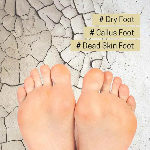 A'PIEU - Soft Foot 30 Minute Peeling Socks 1pair