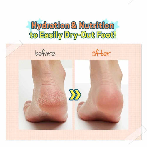 A'PIEU - Soft Foot 30 Minute Peeling Socks 1pair