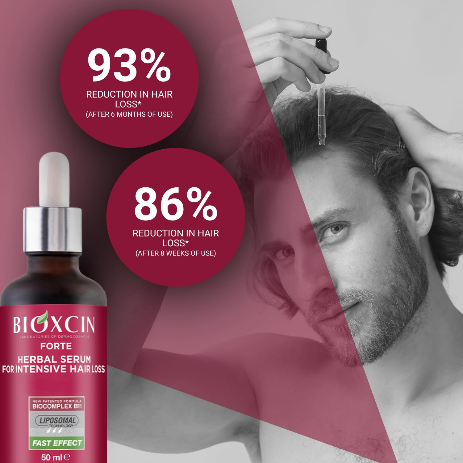 Bioxcin Forte Anti-Hair Loss Hair Growth Serum – 3 × 50 ml